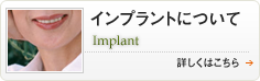 インプラントについて Implant